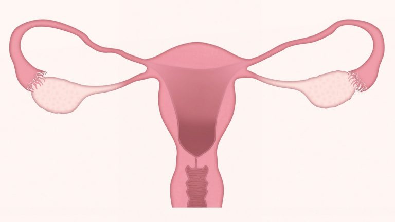 Miomas uterinos desde la MTC