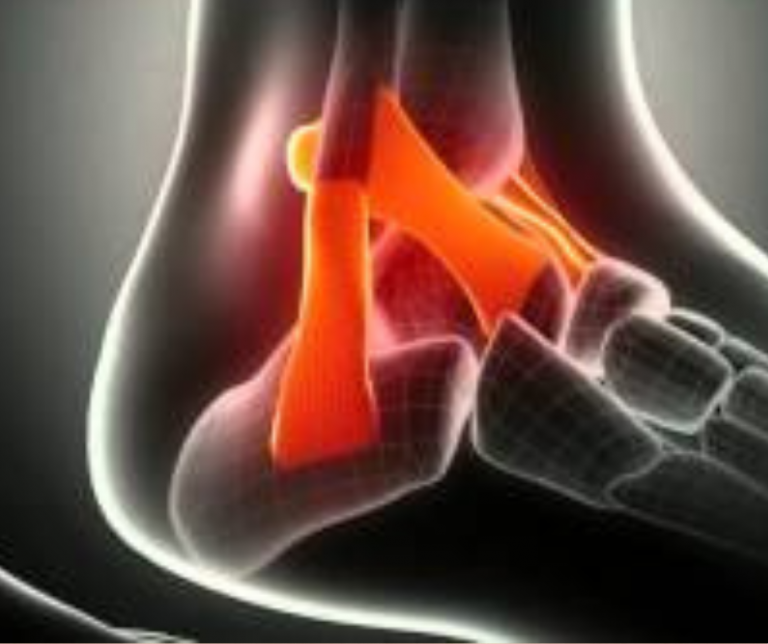 Estimulación ligamentosa, ósea y tendinosa desde la MTC